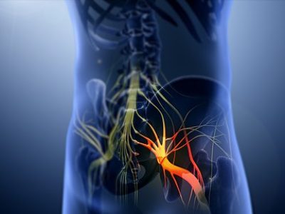 Sciatica_nerve